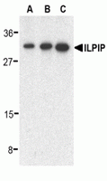 Western blot analysis of ILPIP in human heart lysate with ILPIP antibody at 0.5 (lane A), 1 (lane B), and 2 (lane C) ug/ml, respectively.