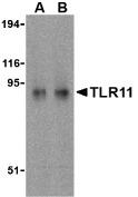 Western blot analysis of TLR11 in RAW264.7 cell lysates with TLR11 antibody at (A) 0.5 and (B) 1 ug/mL.