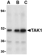 Western blot analysis of TAK1 in Rat thymus cell lysate with TAK1 antibody at (A) 1, (B) 2, and (C) 4 ug/ml.