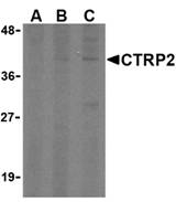 Western blot analysis of CTRP2 in 3T3 (Balb) cell lysate with CTRP2 (IN) antibody at (A) 1, (B) 2, and (C) 4 ug/ml.