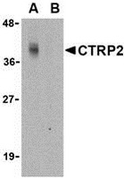 Western blot analysis of CTRP2 in Caco-2 cell lysate with CTRP2 antibody at 1 ug/ml in either the (A) absence or (B) presence of blocking peptide.