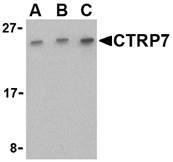 Western blot analysis of CTRP7 in 293 cell lysate with CTRP7 antibody at (A) 0.5, (B) 1, and (C) 2 ug/mL.