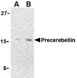 Western blot analysis of precerebellin in 293 cell lysate with precerebellin antibody at (A) 2 and (B) 4 ug/mL.
