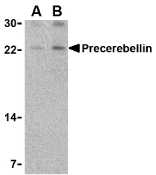 Western blot analysis of precerebellin in mouse cerebellum lysate with precerebellin antibody at (A) 2 and (B) 4 ug/ml.