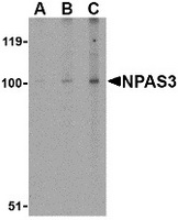 Western blot analysis of NPAS3 in rat brain tissue lysate with NPAS3 antibody at (A) 0.5, (B) 1 and (C) 2 ug/ml.