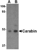Western blot analysis of Carabin in Daudi cell lysate with Carabin antibody at (A) 1 and (B) 2 ug/ml.