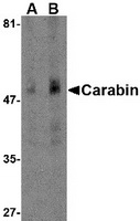 Western blot analysis of Carabin in human spleen tissue lysate with Carabin antibody at (A) 1 and (B) 2 ug/ml.