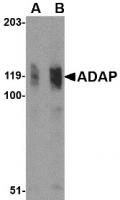 WB Suggested Anti-PSPH Antibody Titration: 0.2-1ug/ml; ELISA Titer: 1:62500; Positive Control: MCF7 cell lysate