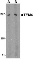 Western blot analysis of TEM4 in Jurkat Cell lysate with TEM4 antibody at (A) 1 and (B) 2 ug/ml.