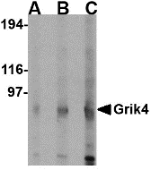 Western blot analysis of Grik4 in rat brain lysate with Grik4 antibody at (A) 0.5 (B) 1 and (C) 2 ug/ml.