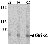 Western blot analysis of Grik4 in Rat brain tissue lysate with Grik4 antibody at (A) 0.5, (B) 1 and (C) 2 ug/ml.