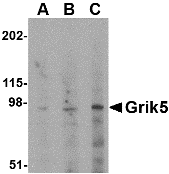 Western blot analysis of Grik5 in human brain tissue lysate with Grik5 antibody at (A) 0.5, (B) 1 and (C) 2 ug/ml.