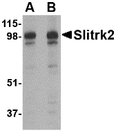 Western blot analysis of Slitrk2 in rat brain tissue lysate with Slitrk2 antibody at (A) 1 and (B) 2 ug/ml.