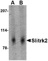 Western blot analysis of Slitrk2 in mouse brain tissue lysate with Slitrk2 antibody at (A) 1 and (B) 2 ug/ml.
