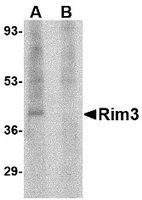 Western blot analysis of Rim3 in human brain tissue lysate with Rim3 antibody at 1 ug/ml in the (A) absence and (B) presence of blocking peptide.