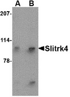 Western blot analysis of Slitrk4 in mouse brain tissue lysate with Slitrk4 antibody at (A) 0.5 and (B) 1 ug/ml.