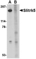 Western blot analysis of Slitrk5 in 3T3 cell lysate with Slitrk5 antibody at 1 ug/ml in the (A) absence or (B) presence of blocking peptide.