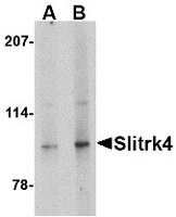 Western blot analysis of Slitrk4 in mouse brain tissue lysate with Slitrk4 antibody at (A) 0.5 and (B) 1 ug/ml.