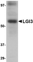 Western blot analysis of LGI3 in human brain tissue lysate with LGI3 antibody at 1 ug/ml.