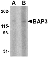 Western blot analysis of BAP3 in SK-N-SH cell lysate with BAP3 antibody at (A) 1 and (B) 2 ug/ml.