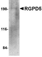Western blot analysis of RGPD5 in human thymus tissue lysate with RGPD5 antibody at 1 ug/ml.