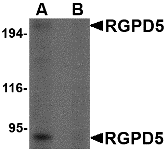 Western blot analysis of RGPD5 in human thymus tissue lysate with RGPD5 antibody at 1 ug/ml in (A) the absence and (B) the presense of blocking peptide.
