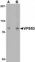 Western blot analysis of VPS53 in 293 cell lysate with VPS53 antibody at (A) 0.5 and (B) 1 ug/mL.