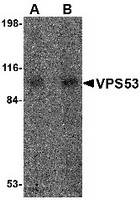 Western blot analysis of VPS53 in 293 cell lysate with VPS53 antibody at (A) 0.5 and (B) 1 ug/ml.