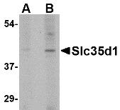 Western blot analysis of Slc35D1 in Daudi lysate with Slc35D1 antibody at (A) 1 and (B) 2 ug/mL.