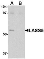 Western blot analysis of LASS5 in SK-N-SH lysate with LASS5 antibody at 1 ug/mL in the (A) absence and (B) presence of blocking peptide.