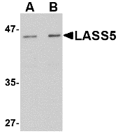 Western blot analysis of LASS5 in rat brain tissue lysate with LASS5 antibody at (A) 1 and (B) 2 ug/ml.