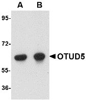 Western blot analysis of OTUD5 in human kidney lysate with OTUD5 antibody at (A) 1 and (B) 2 ug/ml.