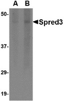 Western blot analysis of Spred3 in human brain tissue lysate with Spred3 antibody at (A) 2 and (B) 4 ug/ml.