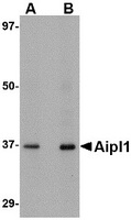 Western blot analysis of Aipl1 in human brain tissue lysate with Aipl1 antibody at (A) 1 and (B) 2 ug/ml.