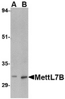 Western blot analysis of MettL7B in rat spleen tissue lysate with MettL7B antibody at (A) 2 and (B) 4 ug/ml.