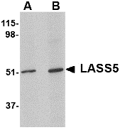 Western blot analysis of LASS5 in SK-N-SH lysate with LASS5 antibody at (A) 1 and (B) 2 ug/ml.