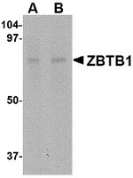 Western blot analysis of ZBTB1 in HepG2 lysate with ZBTB1 antibody at (A) 1 and (B) 2 ug/ml.