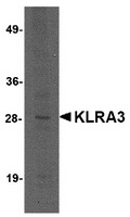 Western blot analysis of KLRA3 in mouse brain tissue lysate with KLRA3 antibody at 2 ug/ml.