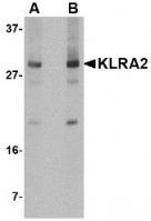 Western blot analysis of KLRA2 in mouse spleen tissue lysate with KLRA2 antibody at (A) 0.5 and (B) 1 ug/mL.