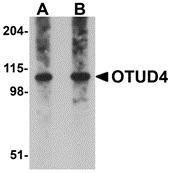 Western blot analysis of OTUD4 in Daudi cell lysate with OTUD4 antibody at (A) 0.25 and (B) 0.5 ug/mL.