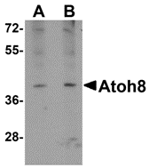 Western blot analysis of ATOH8 in A-20 cell lysate with ATOH8 antibody at (A) 1 and (B) 2 ug/ml.