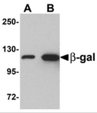 Western blot analysis of (A) 5 and (B) 25 ng of b-gal with b-gal antibody at 1 ug/mL.