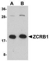 Western blot analysis of ZCRB1 in Raji cell lysate with ZCRB1 antibody at (A) 1 and (B) 2 ug/ml.