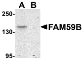 Western blot analysis of FAM59B in SK-N-SH cell lysate with FAM59B antibody at 1 ug/ml in (A) the absence and (B) the presence of blocking peptide.