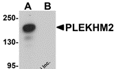 Western blot analysis of PLEKHM2 in rat brain tissue lysate with PLEKHM2 antibody at 0.5 ug/ml in (A) the absence and (B) the presence of blocking peptide.