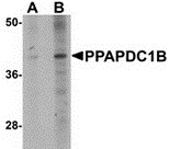 Western blot analysis of PPAPDC1B in EL4 cell lysate with PPAPDC1B antibody at (A) 1 and (B) 2 ug/ml.