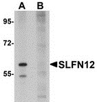 Western blot analysis of SLFN12 in SK-N-SH cell lysate with SLFN12 antibody at 1 ug/ml in (A) the absence and (B) the presence of blocking peptide.