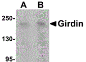Western blot analysis of Girdin in rat brain tissue lysate with Girdin antibody at (A) 1 and (B) 2 ug/ml.