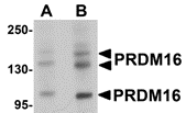 Western blot analysis of PRDM16 in rat brain tissue lysate with PRDM16 antibody at (A) 1 and (B) 2 ug/mL.