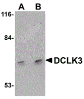 Western blot analysis of DCLK3 in K562 cell lysate with DCLK3 antibody at (A) 1 and (B) 2 ug/mL.